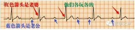 这么教你看心电图，还有什么理由看不懂？