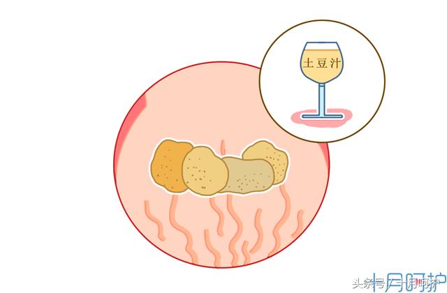 一不小心长了妊娠纹怎么办？这10种方法可以有效缓解和减轻