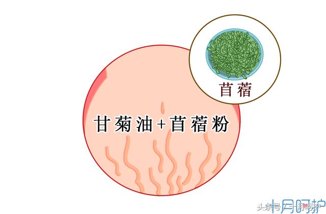 一不小心长了妊娠纹怎么办？这10种方法可以有效缓解和减轻